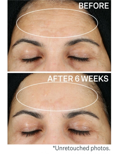 is Clinical - Odmładzające serum z witaminą C Super Serum Advance+