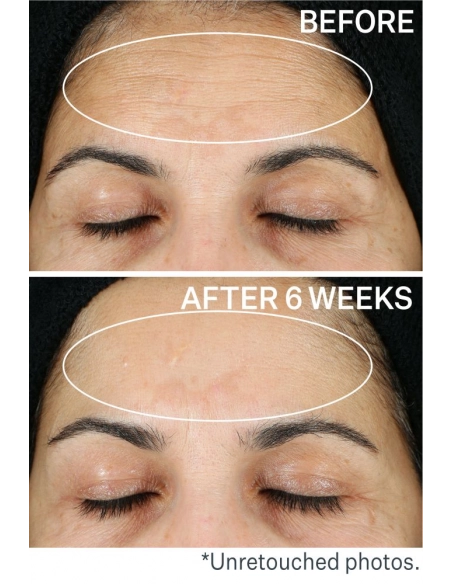 is Clinical - Odmładzające serum z witaminą C Super Serum Advance+